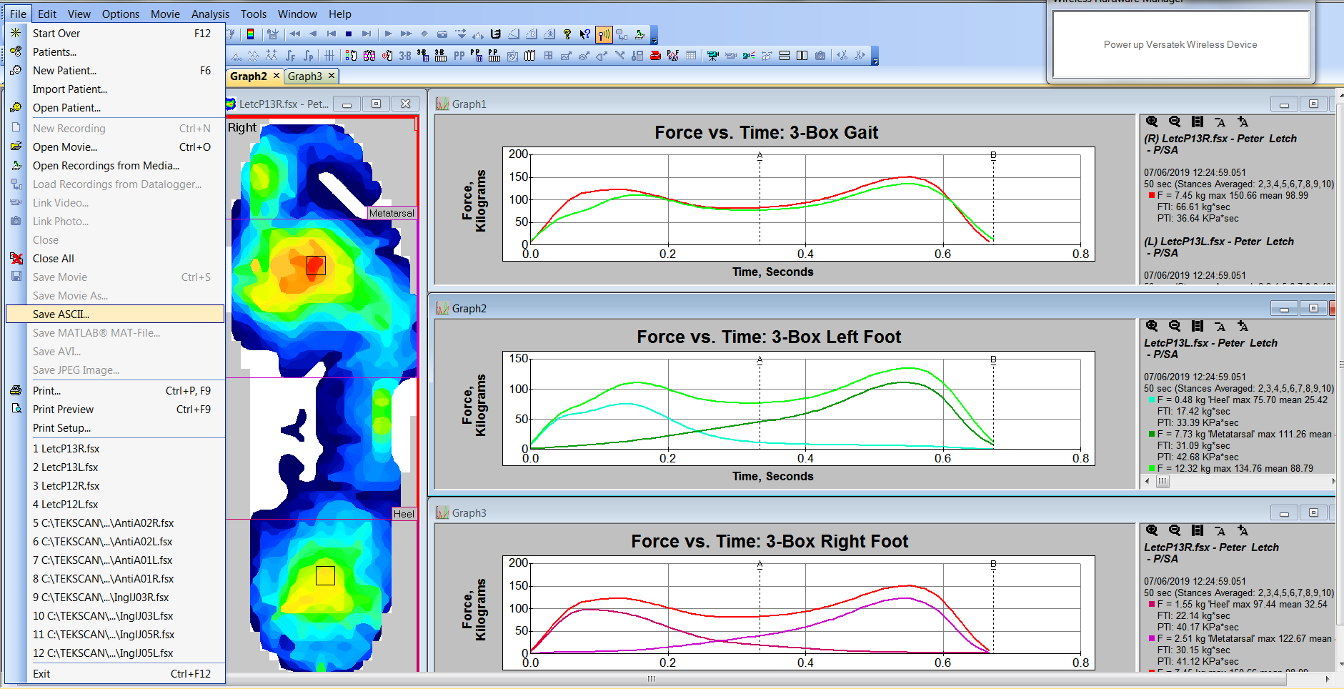 Software Options And Add Ons Biosense Medical