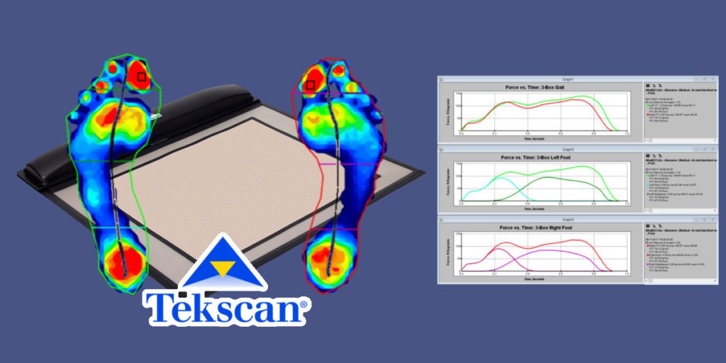 Pressuremat Biosense Medical